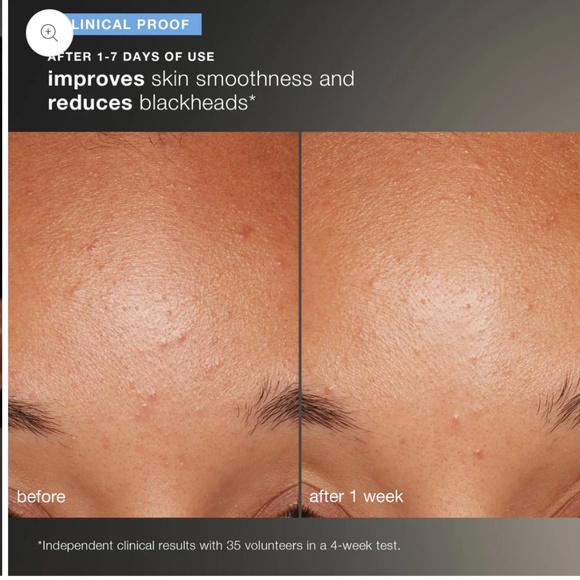 Dermalogica Daily Microfoliant 74g, Full Size 🤩 , clinical grade skincare! - Picture 6 of 7